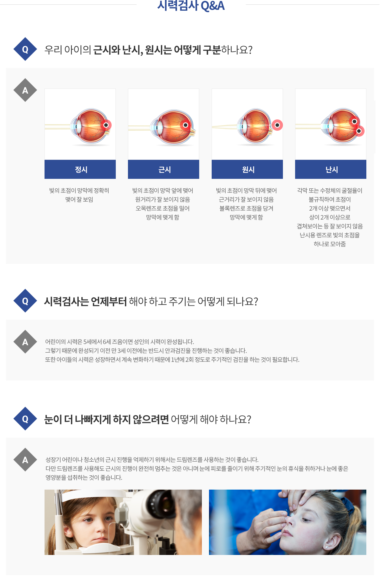 시력검사 Q&A