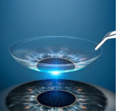 Ultra-precision analysis system